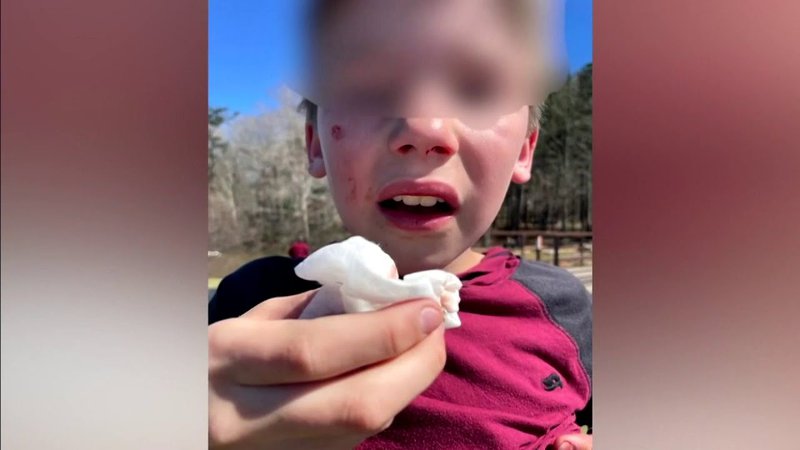 規約に違反したことによるtiktokシャドウ禁止